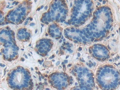 DAB staining on fromalin fixed paraffin- embedded liver tissue)