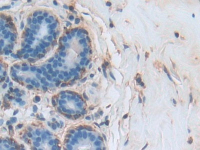 Annexin A3 (ANXA3) Polyclonal Antibody - image 5