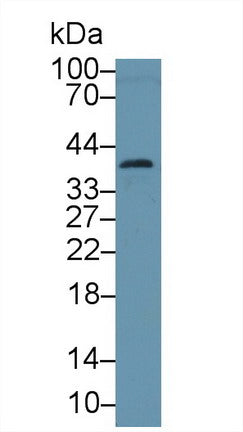 Western Blot; Sample: Recombinant protein.