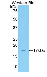 DAB staining on IHC-P; Samples: Mouse Liver Tissue; Primary Ab: 20μg/ml Rabbit Anti-Mouse ANXA3 Antibody Second Ab: 2µg/mL HRP-Linked Caprine Anti-Rabbit IgG Polyclonal Antibody