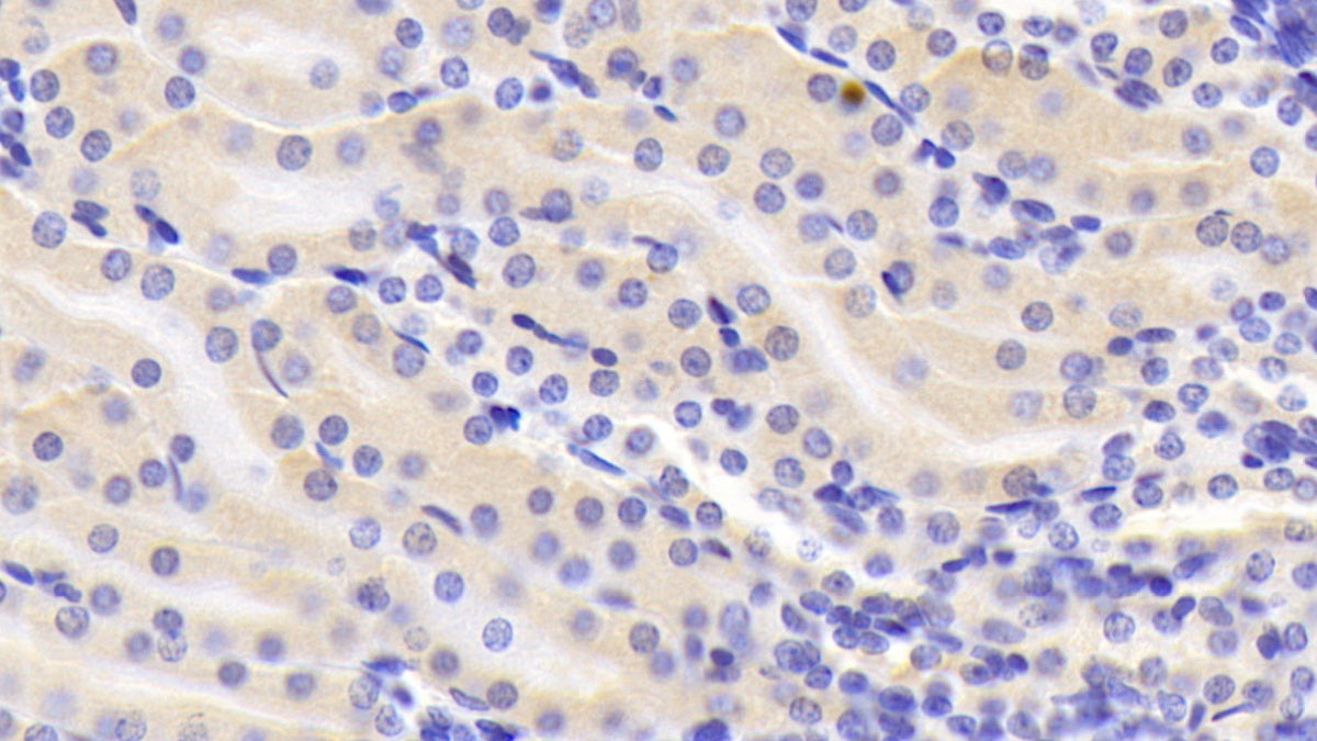 Annexin A3 (ANXA3) Polyclonal Antibody - image 5