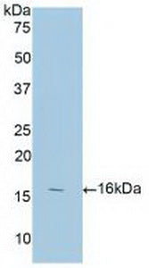 Annexin A3 (ANXA3) Polyclonal Antibody - image 3