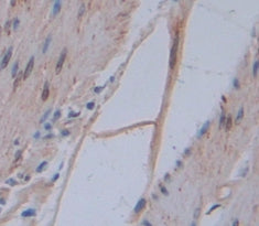 Annexin A3 (ANXA3) Polyclonal Antibody - image 4