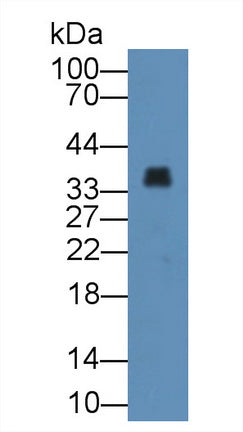 DAB staining on IHC-P; Samples: Human Kidney Tissue;  Primary Ab: 20μg/ml Rabbit Anti-Human ANXA3 Antibody Second Ab: 2µg/mL HRP-Linked Caprine Anti-Rabbit IgG Polyclonal Antibody