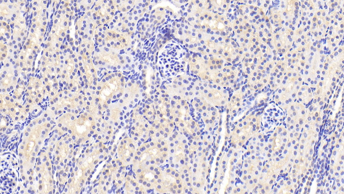Annexin A3 (ANXA3) Polyclonal Antibody - image 4