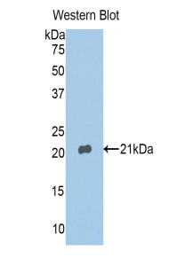 Western Blot; Sample: Lane1: Rat Heart lysate; Lane2: Rat Kidney lysate; Lane3: Rat Placenta lysate; Lane4: Mouse Raw264.7 cell lysate; Primary Ab: 2µg/mL Rabbit Anti-Rat ANXA4 Antibody; Second Ab: 0.2µg/mL HRP-Linked Caprine Anti-Rabbit IgG Polyclonal Antibody;