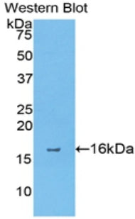 Western Blot; Sample: Rat Pancreas lysate; ; Primary Ab: 2µg/ml Rabbit Anti-Rat ANXA4 Antibody; Second Ab: 0.2µg/mL HRP-Linked Caprine Anti-Rabbit IgG Polyclonal Antibody;