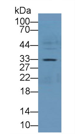 DAB staining on IHC-P; Samples: Rat Kidney Tissue; Primary Ab: 10µg/ml Rabbit Anti-Rat ANXA4 Antibody Second Ab: 2µg/mL HRP-Linked Caprine Anti-Rabbit IgG Polyclonal Antibody