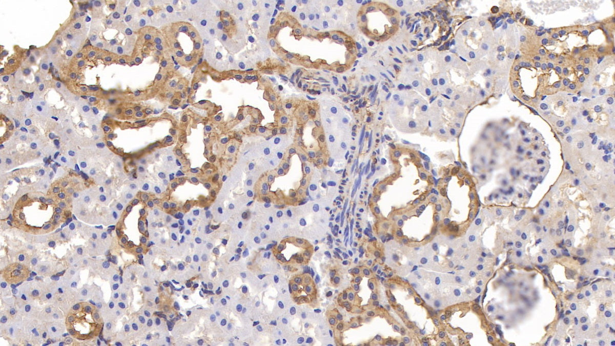DABstainingonIHC-P.Samples:RatTissue)