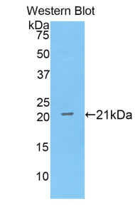 Western Blot; Sample: Lane1: Porcine Small intestine lysate; Lane2: Porcine Uterus lysate; Lane3: Porcine Kidney lysate; Lane4: Porcine Stomach lysate; Lane5: Porcine Liver lysate; Primary Ab: 2µg/mL Rabbit Anti-Porcine ANXA4 Antibody; Second Ab: 0.2µg/mL HRP-Linked Caprine Anti-Rabbit IgG Polyclonal Antibody;