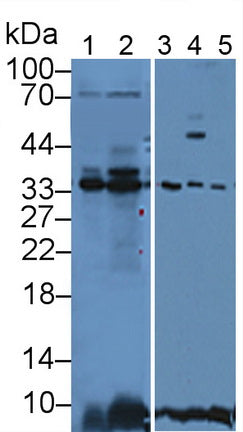 DAB staining on IHC-P; Samples: Porcine Stomach Tissue; Primary Ab: 10µg/ml Rabbit Anti-Porcine ANXA4 Antibody Second Ab: 2µg/mL HRP-Linked Caprine Anti-Rabbit IgG Polyclonal Antibody