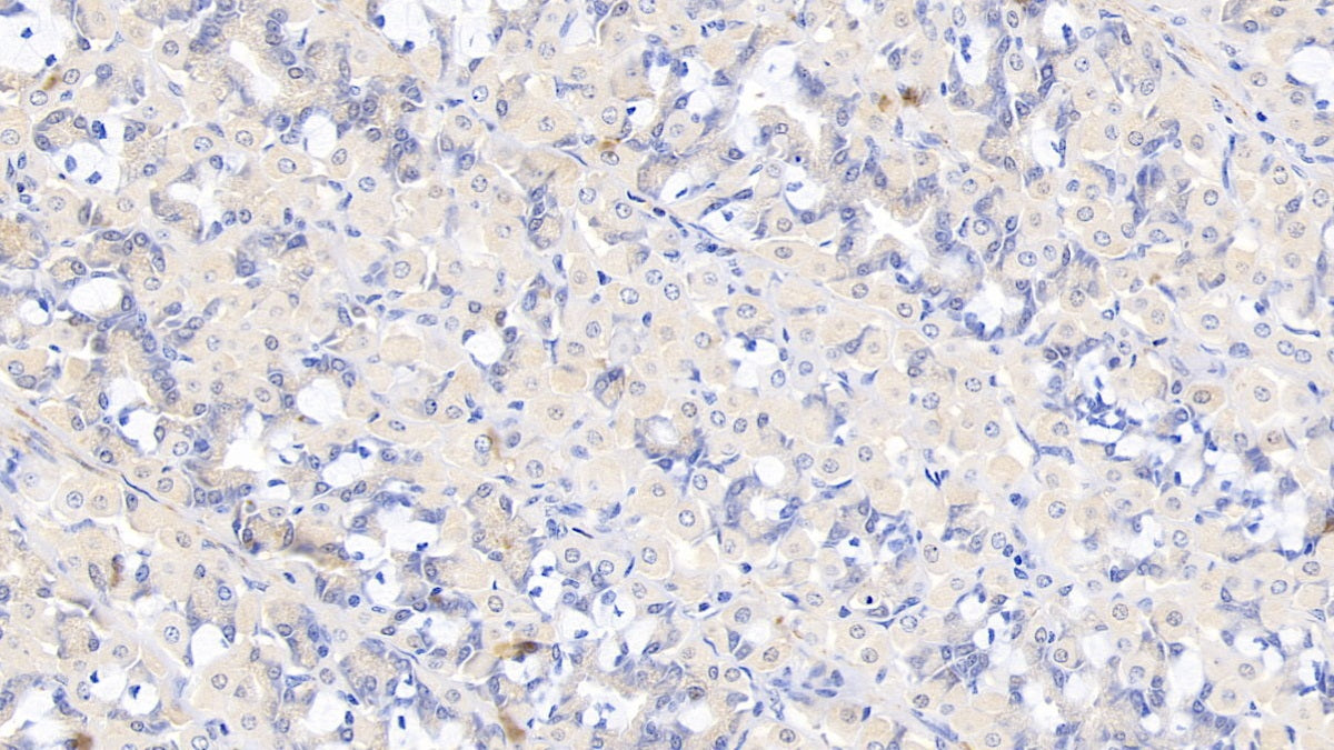 DAB staining on IHC-P; Samples: Human Placenta Tissue;  Primary Ab: 10µg/ml Rabbit Anti-Porcine ANXA4 Antibody Second Ab: 2µg/mL HRP-Linked Caprine Anti-Rabbit IgG Polyclonal Antibody