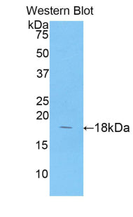 DAB staining on IHC-P; Samples: Human Placenta Tissue; Primary Ab: 20μg/ml Rabbit Anti-Porcine ANXA4 Antibody Second Ab: 2µg/mL HRP-Linked Caprine Anti-Rabbit IgG Polyclonal Antibody