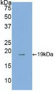 DAB staining on IHC-P; Samples: Human Stomach Tissue; Primary Ab: 20µg/ml Rabbit Anti-Human ANXA4 Antibody Second Ab: 2µg/mL HRP-Linked Caprine Anti-Rabbit IgG Polyclonal Antibody