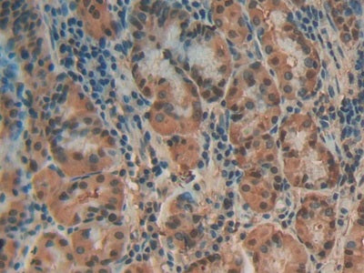 DAB staining on IHC-P; Samples: Human Liver Tissue.