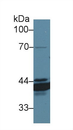 Western Blot; Sample: Recombinant protein.