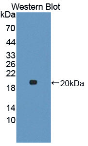 DAB staining on IHC-P; Samples: Bovine Liver Tissue; Primary Ab: 20μg/ml Rabbit Anti-Bovine ANXA4 Antibody Second Ab: 2µg/mL HRP-Linked Caprine Anti-Rabbit IgG Polyclonal Antibody
