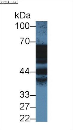 Western Blot; Sample: Recombinant protein.