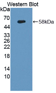 DAB staining on IHC-P; Samples: Human Cerebrum Tissue; Primary Ab: 30µg/ml Rabbit Anti-Human ANXA11 Antibody Second Ab: 2µg/mL HRP-Linked Caprine Anti-Rabbit IgG Polyclonal Antibody
