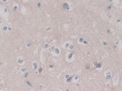 DAB staining on IHC-P. Samples: Human Tissue)