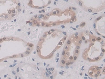 Annexin A11 (ANXA11) Polyclonal Antibody - image 5