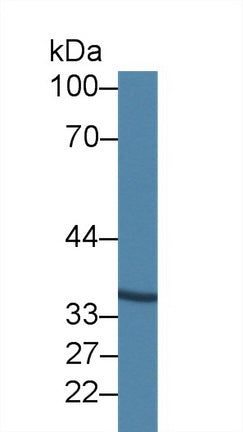 Western Blot; Sample: Recombinant protein.
