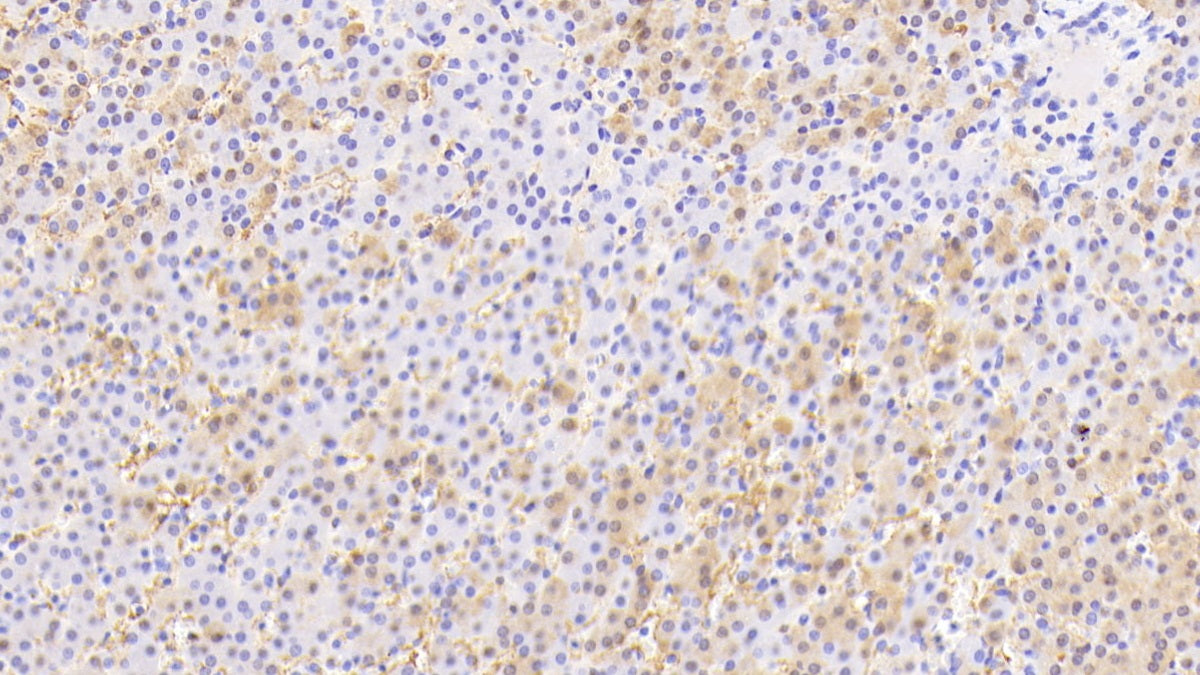 DAB staining on fromalin fixed paraffin- embedded skin tissue)
