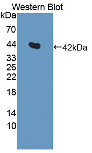 Western Blot; Sample: Lane1: Rat Serum; Lane2: 293T cell lysate; Lane3: Rat Skeletal muscle lysate; Lane4: Mouse Skeletal muscle lysate; Primary Ab: 2µg/ml Rabbit Anti-Rat IL11Ra Antibody; Second Ab: 0.2µg/mL HRP-Linked Caprine Anti-Rabbit IgG Polyclonal Antibody;