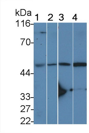 DAB staining on IHC-P; Sample: Rat Kidney Tissue;  Primary Ab: 20ug/ml Rabbit Anti-Rat IL11Ra Antibody Second Ab: 2µg/mL HRP-Linked Caprine Anti-Rabbit IgG Polyclonal Antibody