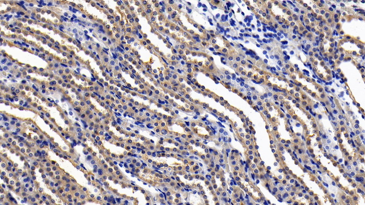 Interleukin 11 Receptor Alpha (IL11Ra) Polyclonal Antibody - image 4