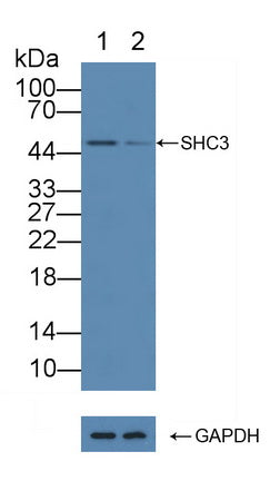 DAB staining on IHC-P; Samples: Human Glioma Tissue; Primary Ab: 10µg/ml Rabbit Anti-Human SHC3 Antibody Second Ab: 2µg/mL HRP-Linked Caprine Anti-Rabbit IgG Polyclonal Antibody