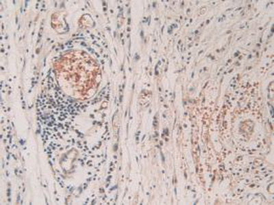 SHC-Transforming Protein 3 (SHC3) Polyclonal Antibody - image 5