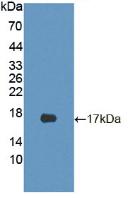 Cyclin Dependent Kinase Inhibitor 2B (CDKN2B) Polyclonal Antibody - image 2