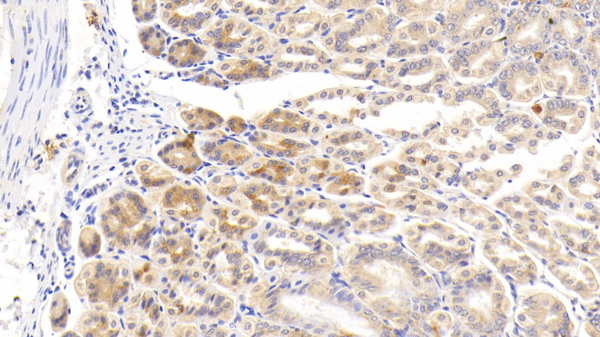 DAB staining on fromalin fixed paraffin- embedded intestine tissue)