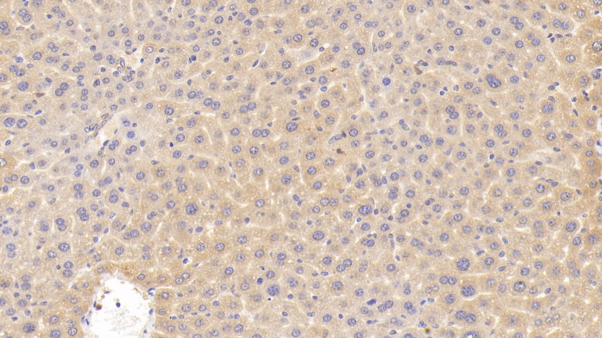 Cyclin Dependent Kinase Inhibitor 2B (CDKN2B) Polyclonal Antibody - image 4
