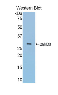 Alpha-1-B-Glycoprotein (a1BG) Polyclonal Antibody - image 2