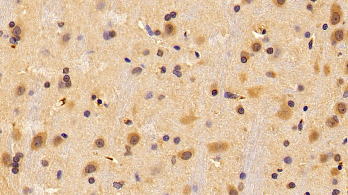 DABstainingonIHC-P.Samples:RatTissue)