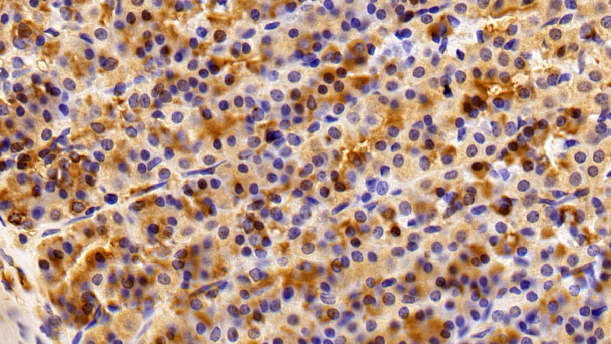 Alpha-1-B-Glycoprotein (a1BG) Polyclonal Antibody - image 4