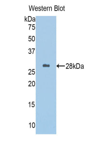 Alpha-1-B-Glycoprotein (a1BG) Polyclonal Antibody - image 2