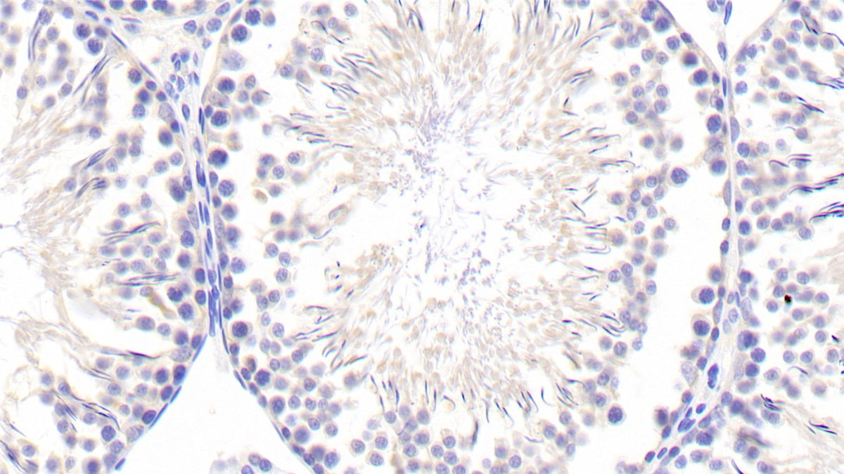 DABstainingonIHC-P.Samples:RatTissue)