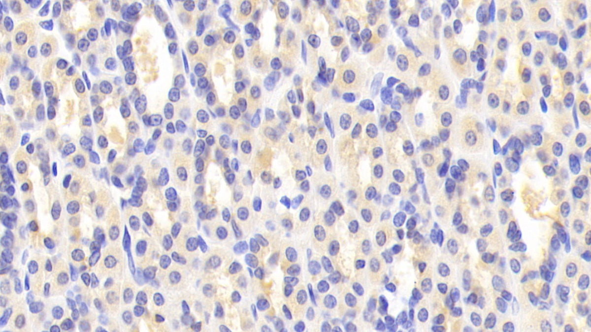 Alpha-1-B-Glycoprotein (a1BG) Polyclonal Antibody - image 4