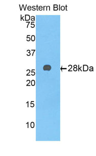 Alpha-1-B-Glycoprotein (a1BG) Polyclonal Antibody - image 2