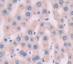 Alpha-1-B-Glycoprotein (a1BG) Polyclonal Antibody - image 3