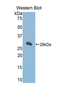 DAB staining on IHC-P; Samples: Mouse Liver Tissue;  Primary Ab: 20μg/ml Rabbit Anti-Mouse a1BG Antibody Second Ab: 2µg/mL HRP-Linked Caprine Anti-Rabbit IgG Polyclonal Antibody
