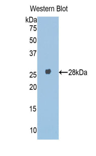 DAB staining on IHC-P; Samples: Mouse Liver Tissue; Primary Ab: 20μg/ml Rabbit Anti-Mouse a1BG Antibody Second Ab: 2µg/mL HRP-Linked Caprine Anti-Rabbit IgG Polyclonal Antibody