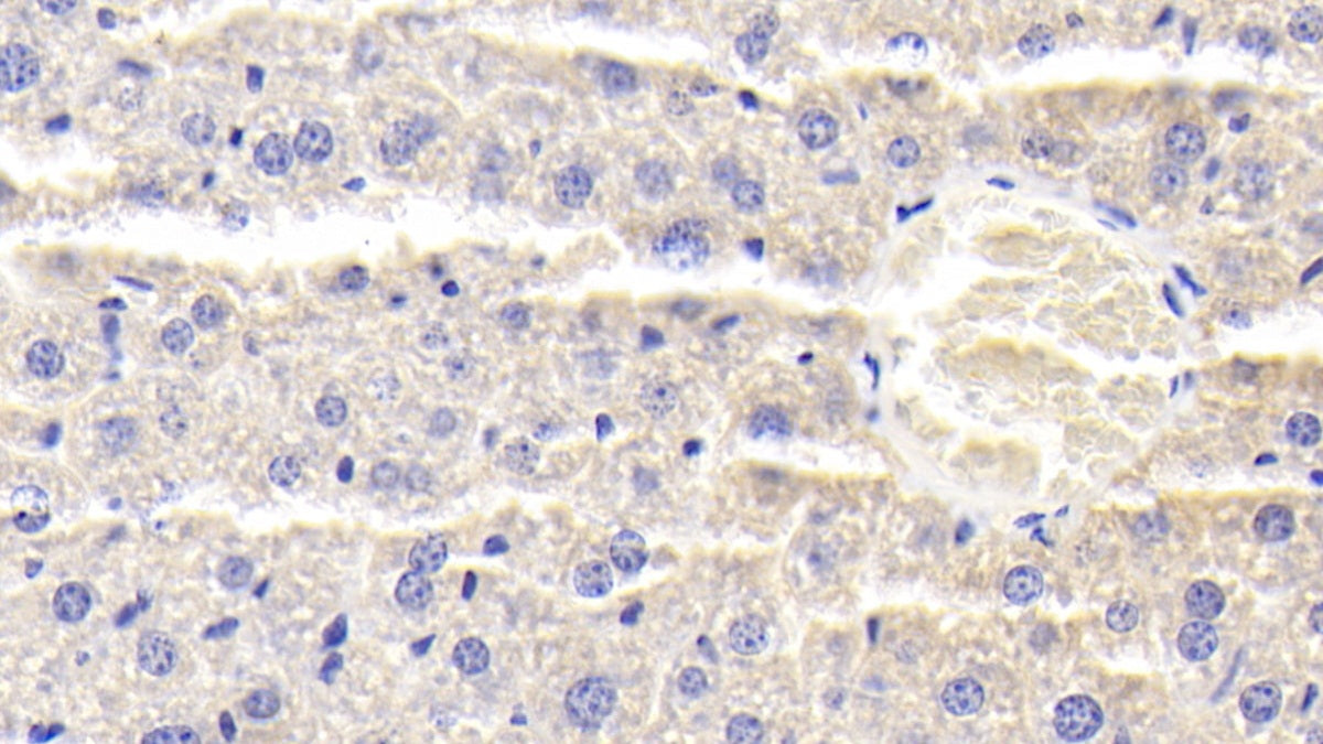DAB staining on fromalin fixed paraffin-embedded Liver tissue)