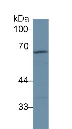 Western Blot; Sample: Recombinant protein.