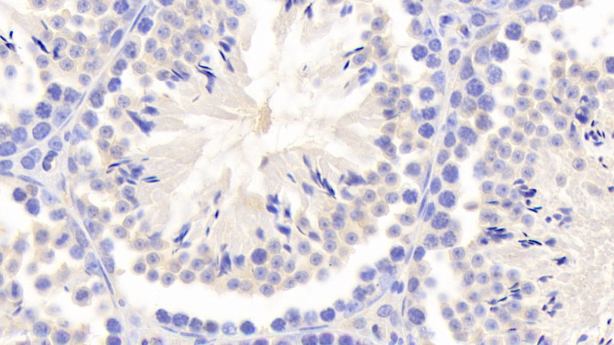 DAB staining on fromalin fixed paraffin-embedded Liver tissue)