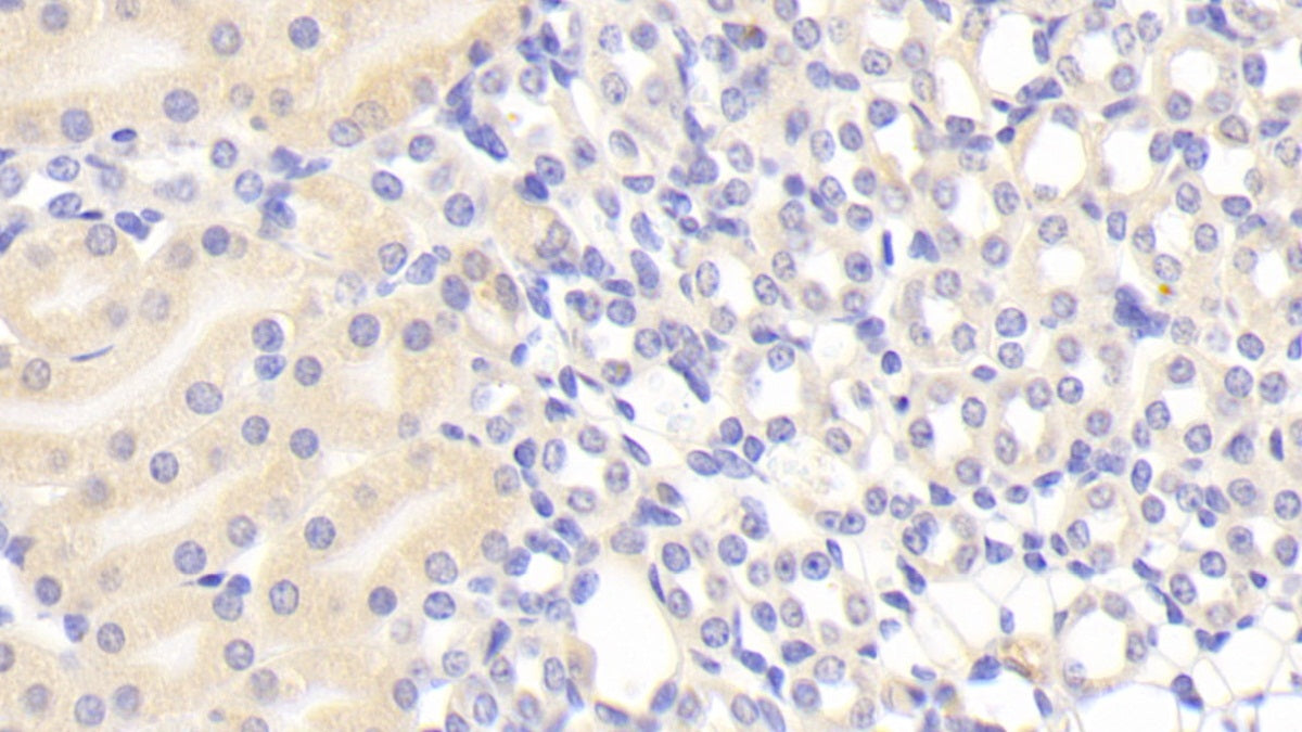 Alpha-1-B-Glycoprotein (a1BG) Polyclonal Antibody - image 5