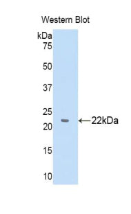 Alpha-1-B-Glycoprotein (a1BG) Polyclonal Antibody - image 3